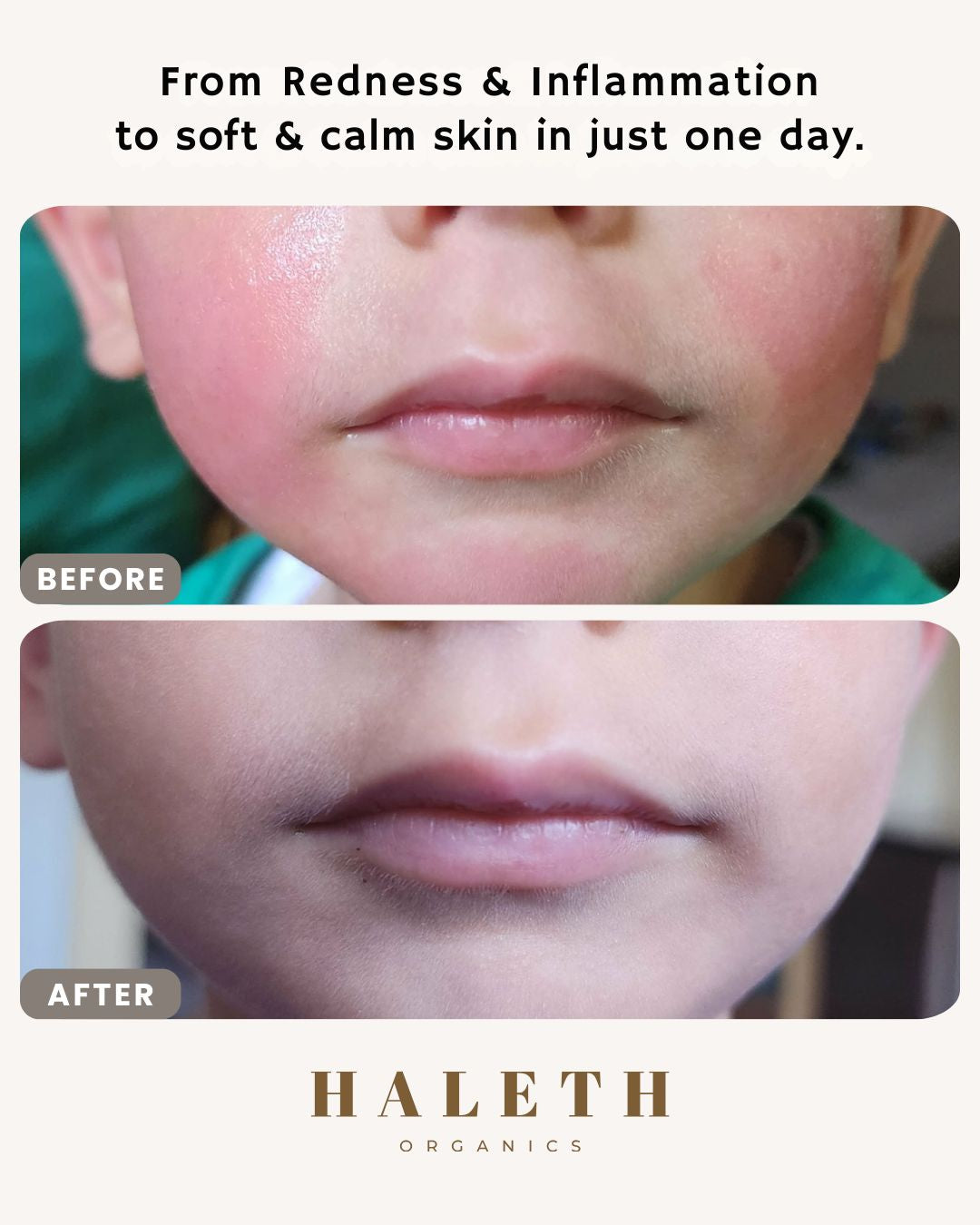 Camel Milk Moisturiser Balm Duo | 2-Pack Value Set (2 x 50g)
